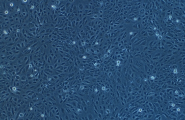 SV-HUC-1人膀胱上皮永生化细胞