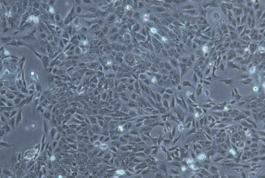 SV-HUC-1人膀胱上皮永生化细胞