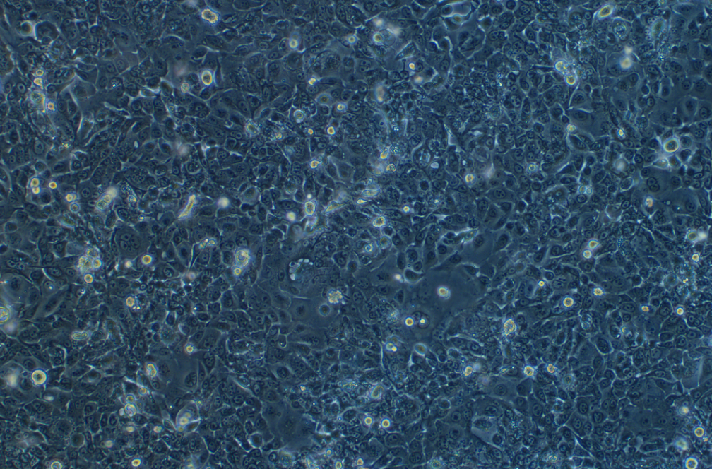 山羊乳腺上皮细胞(永生化细胞） Goat mammary epithelial cells immortalized cells