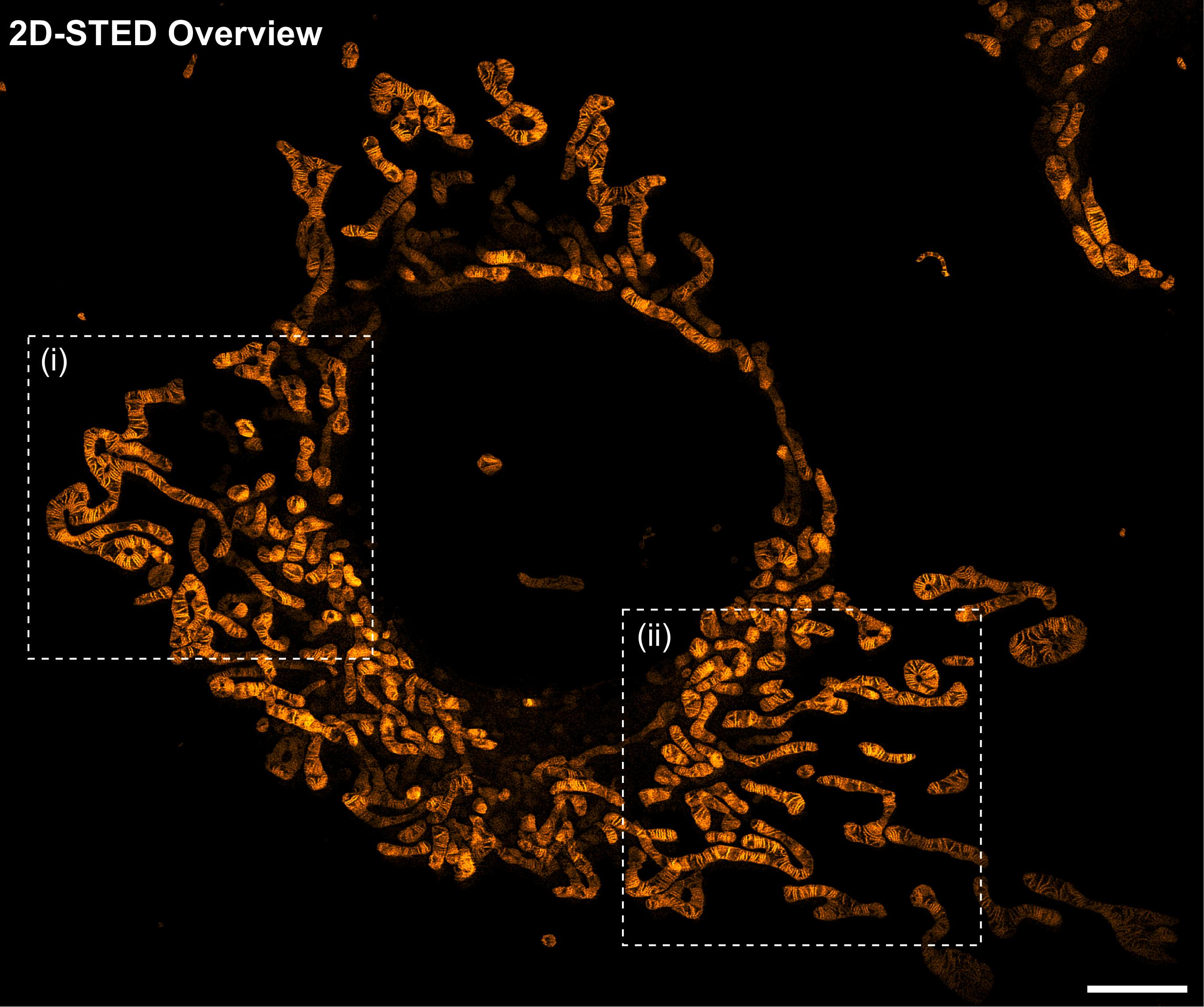 超分辨活细胞线粒体荧光探针Orange